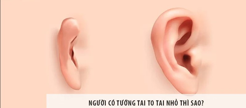 Xem tướng người có 2 tai khác nhau theo nhân tướng học Xem tuong nguoi co 2 tai khac nhau theo nhan tuong hoc